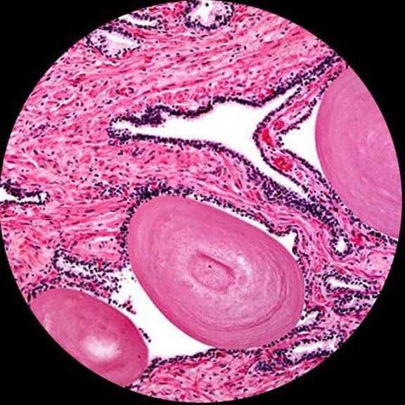 amscope-b100b-5m-binokular-mikroskop-2000x-mit-5mp-usb-kamera image 8