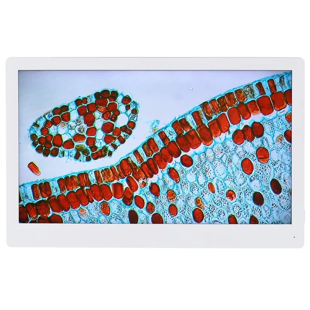 amscope-hdm-11-6-hdmi-monitor-f-r-hd1080-mikroskopkameras image 1