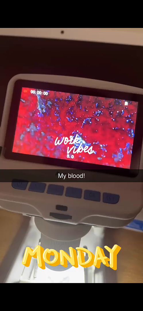 Display top
