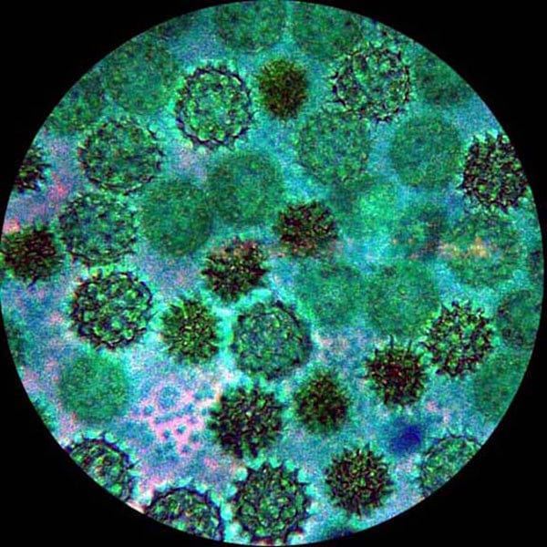 amscope-t690c-m-trinokular-mikroskop-1-3mp-40x-2500x image 8
