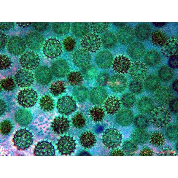 amscope-in300tb-inf-inversmikroskop-800x-trinokular-phasenkontrast image 8